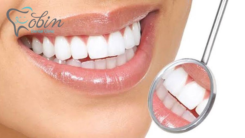 روش های معروف ترمیم دندان 